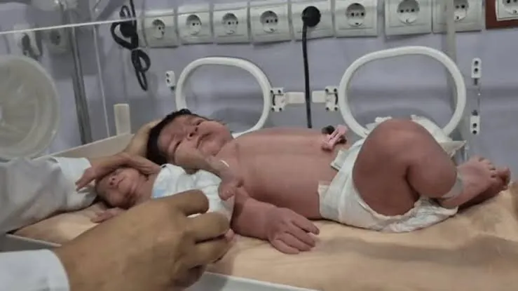 تولد نوزادی با وزن غیرمعمول ۵ کیلو و ۷۰۰ گرم در بندرعباس