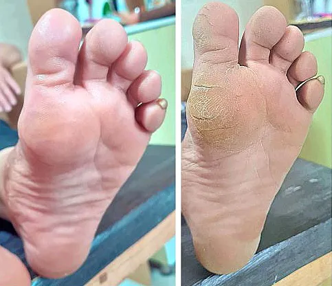 مراقبت از سلامت و زیبایی پا با رعایت اصول بهداشتی و انجام صحیح پدیکور