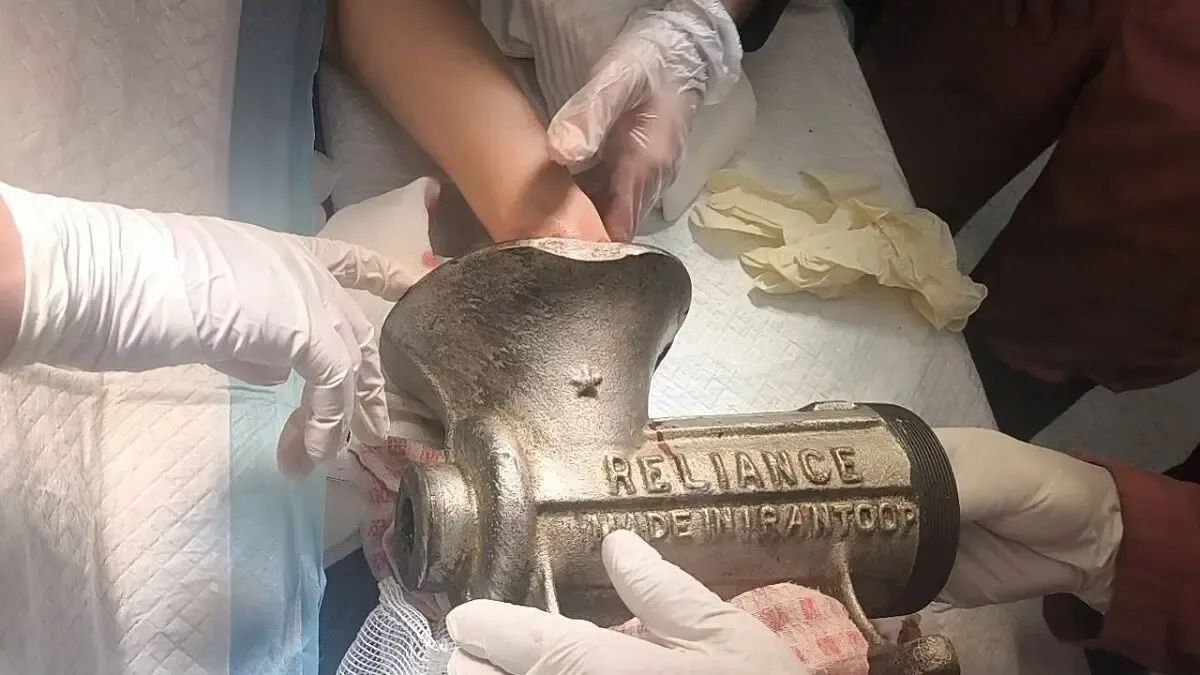 جراحت شدید دست زن کارگر در چرخگوشت در مرکز تهران
