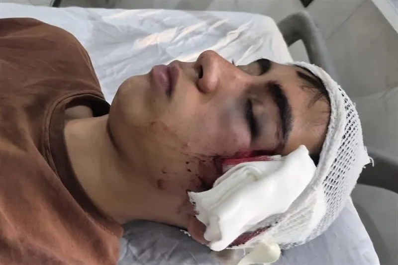 آخرین وضعیت پرونده تنبیه بدنی دانشآموز در دهبکری؛ معلم تعلیق شد