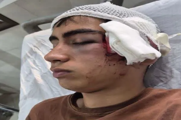 مصدومیت یک دانشآموز در پی برخورد فیزیکی معلم در بم