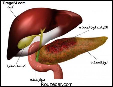 کبد چرب,درمان کبد چرب,علت کبد چرب,علائم ابتلا به کبد چرب