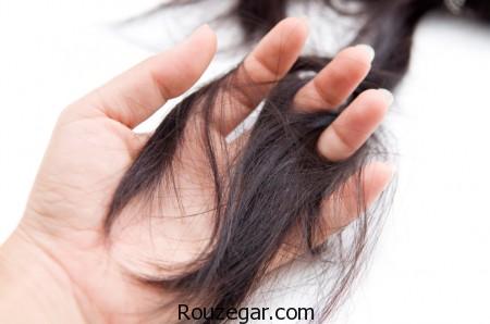 درمان ریزش مو,عوامل مهم ریزش مو,علل ریزش مو