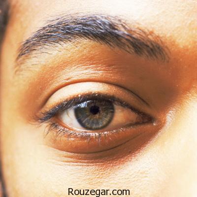 علت پریدن پلک چشم