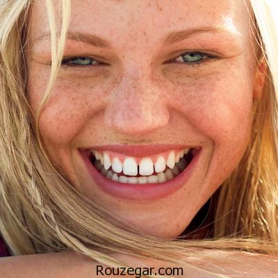 بهترین راه درمان کک و مک