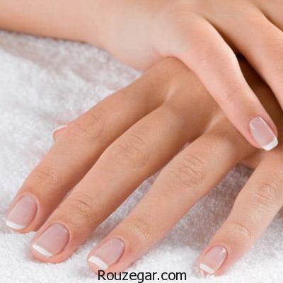 علت زرد شدن ناخن و راه درمان آن