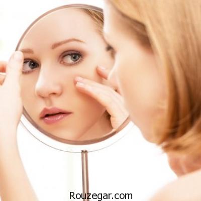علت جوش های روی قسمت های مختلف صورت