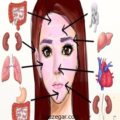 علت جوش های روی قسمت های مختلف صورت