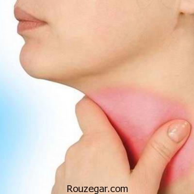 روش هایی برای درمان گلودرد