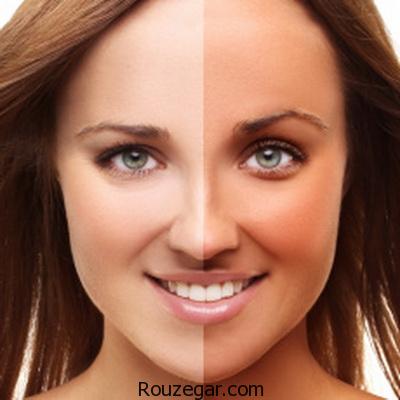 ‎برنزه کردن پوست بدون استفاده از دستگاه