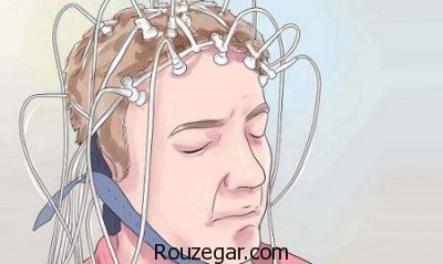 دارو برای بیماری صرع،دلیل حملات صرع،درمان صرع با طب سنتی