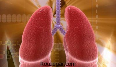 داروی آبسه ریه،درمان سریع آبسه ریه،درباره آبسه ریه