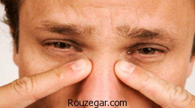 قطره ضد احتقان بینی،احتقان بینی در حاملگی،احتقان بینی سرماخوردگی