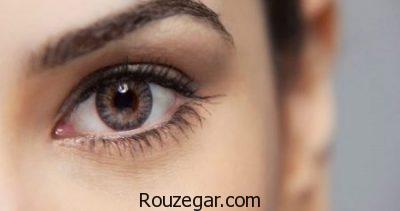 التهاب عنبیه در کودکان،روش درمان التهاب عنبیه،التهاب عنبیه چیست