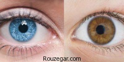 التهاب عنبیه در کودکان،روش درمان التهاب عنبیه،التهاب عنبیه چیست