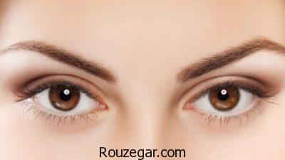 التهاب عنبیه در کودکان،روش درمان التهاب عنبیه،التهاب عنبیه چیست