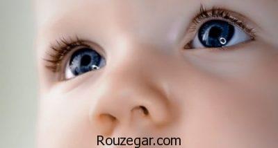 علل ایجاد انحراف چشم،علائم انحراف چشم مخفی،انحراف چشم در نوزاد