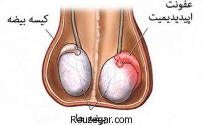 نازایی در مردان چیست،علت نازایی در مردان،درمان گیاهی نازایی در مردان