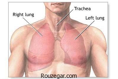 درمان قطعی ذات الریه،درمان طب سنتی ذات الریه،داروی گیاهی برای ذات الریه