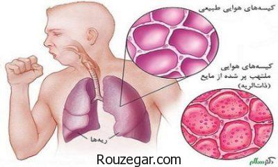 درمان قطعی ذات الریه،درمان طب سنتی ذات الریه،داروی گیاهی برای ذات الریه
