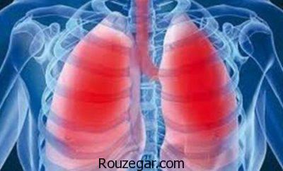 درمان قطعی ذات الریه،درمان طب سنتی ذات الریه،داروی گیاهی برای ذات الریه