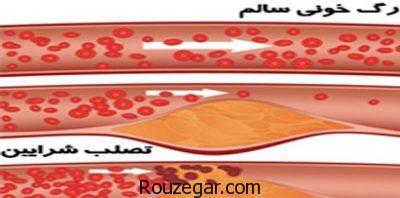آترواسکلروز عروقی،آترواسکلروز شریان کرونر،آترواسکلروز در کودکان