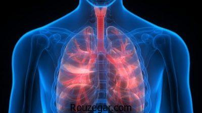 رژیم غذایی آمبولی ریه،عوارض آمبولی ریه،داروی گیاهی برای آمبولی ریه