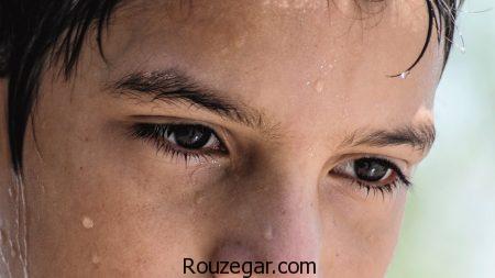 علت عرق کردن سر، علت عرق کردن سر در نوزاد