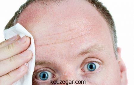 علت عرق کردن سر، علت عرق کردن سر در نوزاد