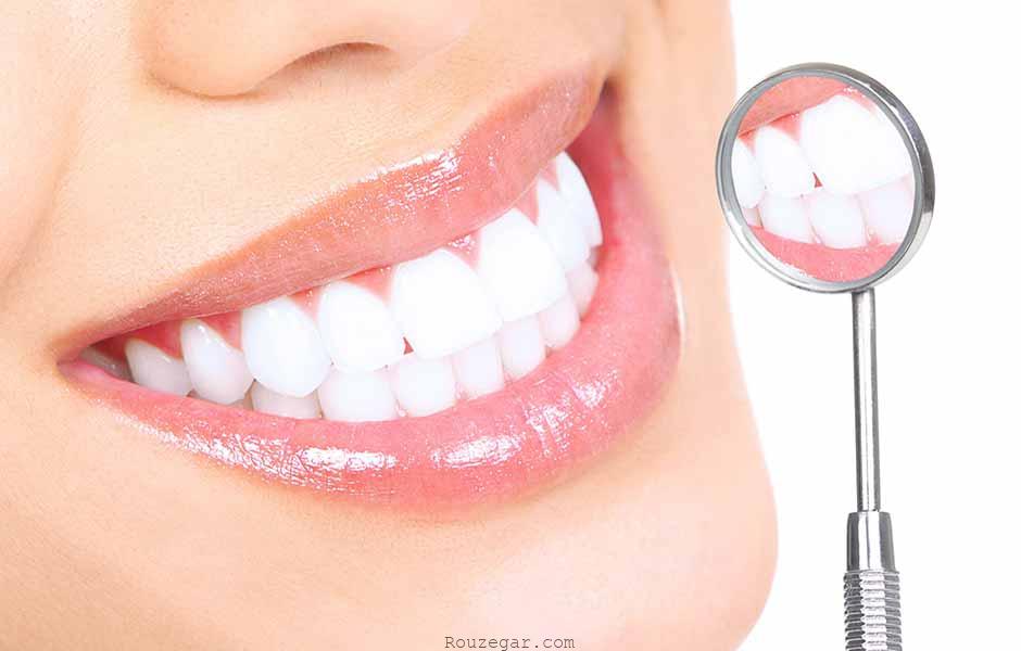روش‌های مختلف زیبایی دندان