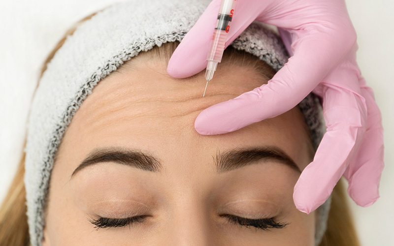 بوتاکس خطوط پیشانی